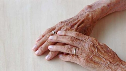 arthrite en vieillissant